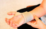 Лечение растяжения связок руки