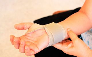 Лечение растяжения связок руки