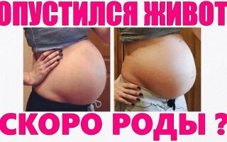 Как понять что живот опустился перед родами